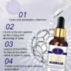 Aichun Beauty Anti Acne Whitening Facial Serum