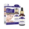 Aichun Beauty Anti Acne Whitening Facial Serum