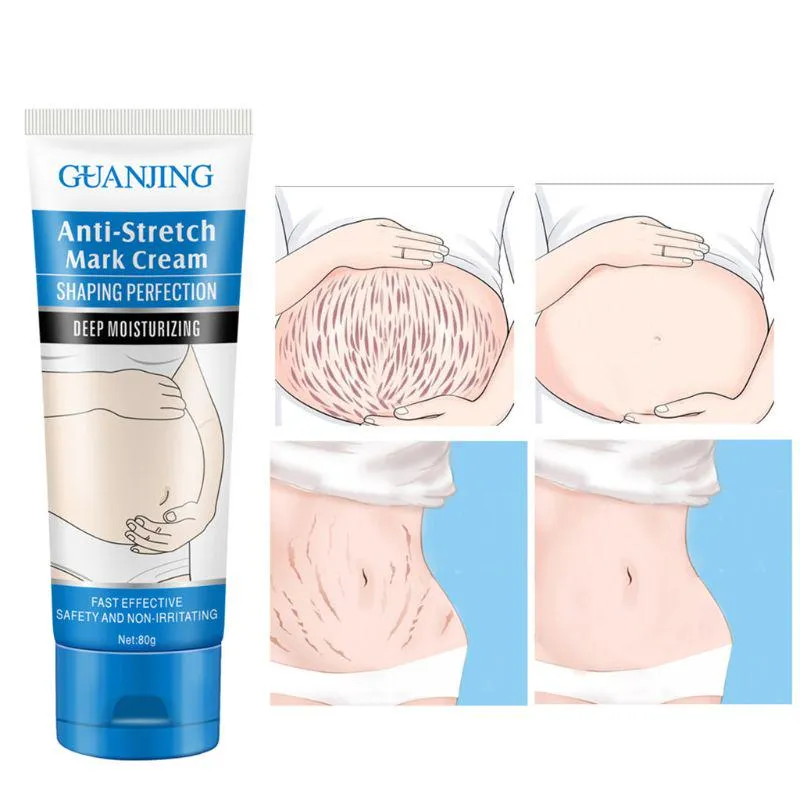 Guanjing Stretch Mark Cream